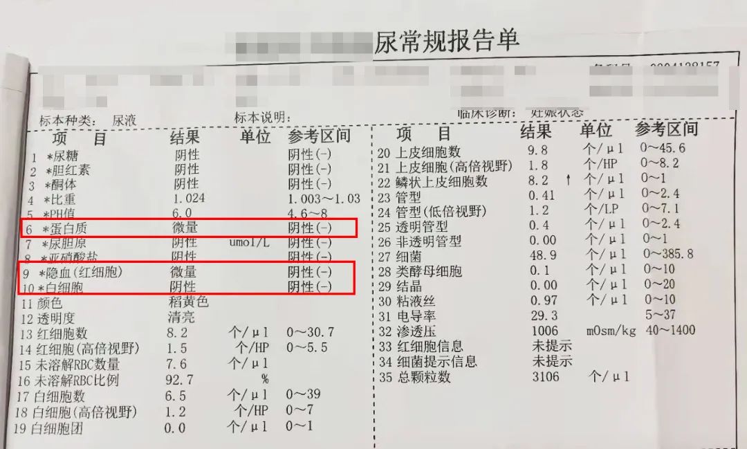 所以,当怀疑肾脏有问题,通常会做以下3个检查: 1,尿常规: 检查尿液