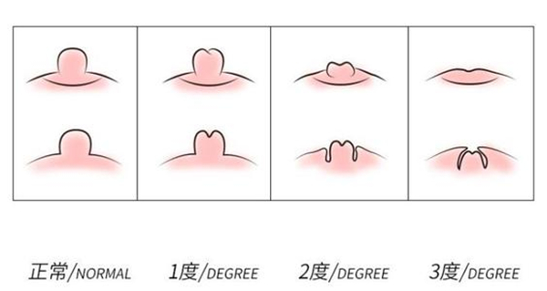 健康乳头是什么样子的图片